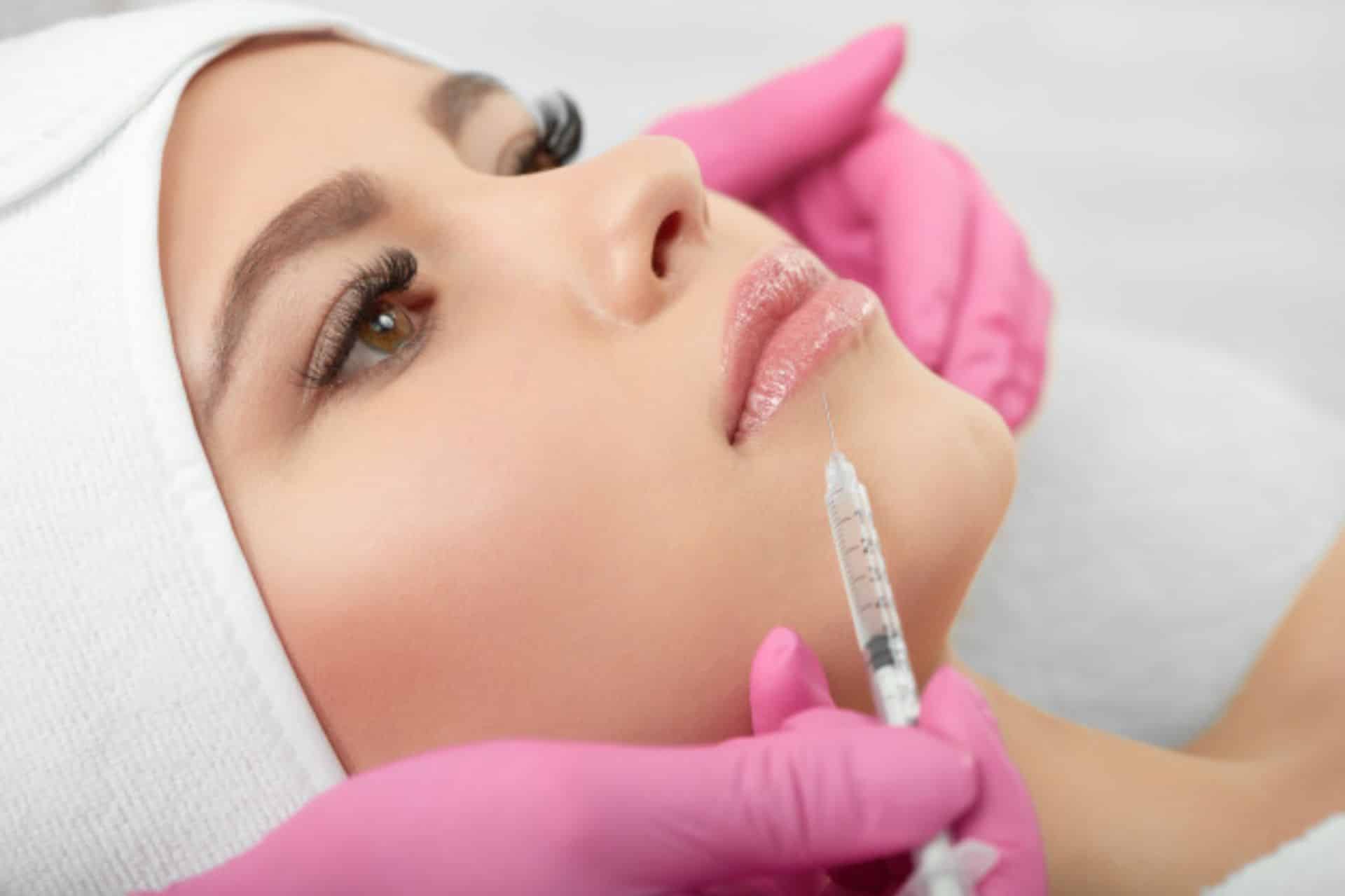 Lip  development  once dermal fillers  Dental centar Ostoji